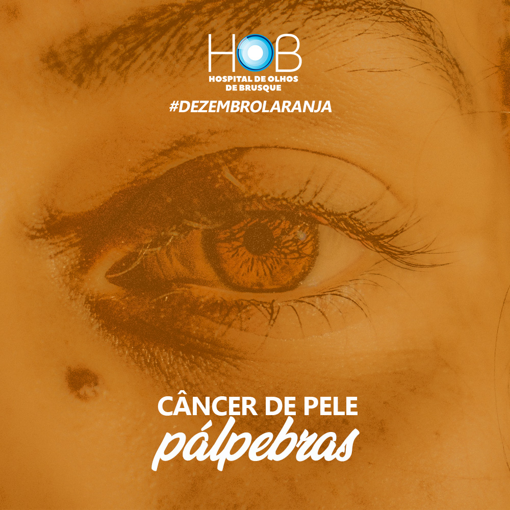 CNCER DE PELE | PLPEBRAS